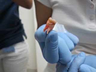 Ma dent